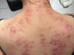 -天然沐足·推背采耳·敷姜艾灸(龙眼美食街店)