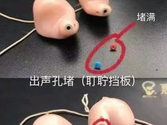 -惠耳听力助听器(霍邱新蓼大道店)