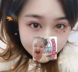 -成都西区医院整形美容