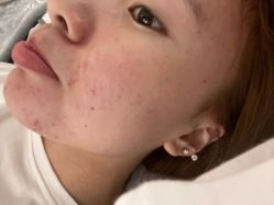 -skin79皮肤管理中心