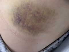 -成都市第一人民医院(南区)