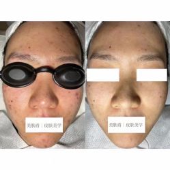 -美肤盾祛痘·问题肌头疗管理中心