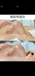 点击看大图 -栖SPA·ONDA ·美芙炫·海菲秀科技美肤中心