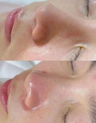 -美愈美肤MEIYU SKIN