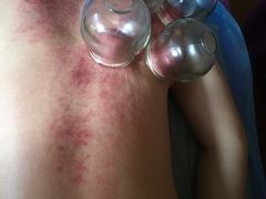 -沈师傅盲人按摩工作室(密三小区店)