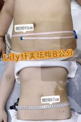 -Lily纤美·科技减脂中心