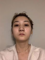 体验前-深圳阳光医疗美容医院·旗舰店
