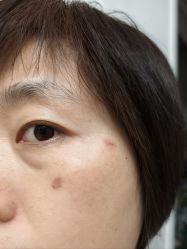 -空军总医院激光整形美容中心