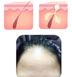 -苗方清颜痘肌研究所