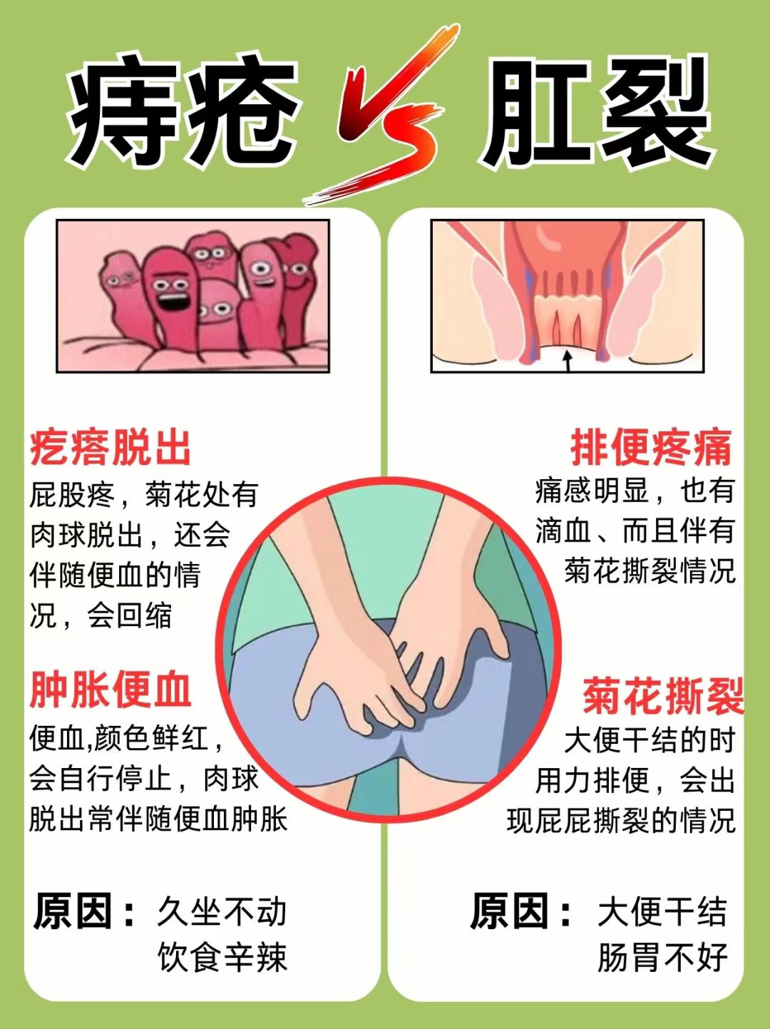 怎样分辨是不是痔疮图片