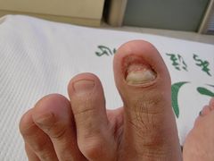 -足护氏采耳修脚(七克拉店)