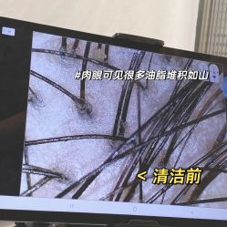-润复丝·泽发防脱头皮管理