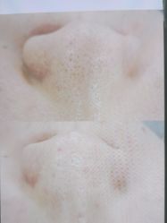 -SKIN79皮肤管理中心