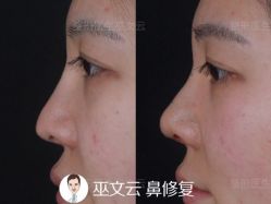 -北京米扬丽格医疗美容·联合丽格鼻整形中心