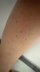 -More摩尔医美の注射线雕光电中心