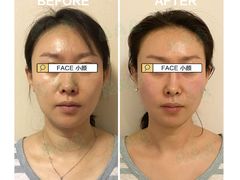 -FACE·日本小颜美容整骨(福田店)