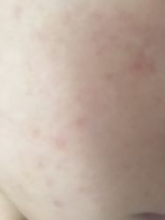 点击看大图 -MedSkinCare科技祛痘肌肤修护中心