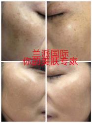 -兰派国际美容养生SPA