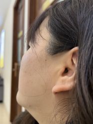 -长沙雅美医疗美容医院