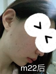 -北京米扬丽格医疗美容·联合丽格鼻整形中心
