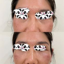 -广州健丽·去眼袋医疗美容机构