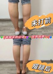 -温州伯思立医院