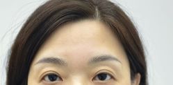 -Doris多里斯半永久纹眉·SMP纹发·发际线