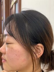 -长沙雅美医疗美容医院
