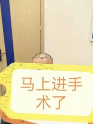 -大麦微针植发全国连锁
