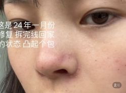 -上海玫瑰医疗美容医院