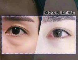-上海漾颜医疗美容