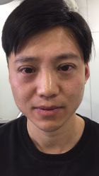 -天津健丽·去眼袋医疗美容机构