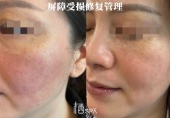 点击看大图 -栖SPA·ONDA ·海菲秀·皑皑科技美肤中心