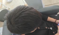 -大麦微针植发丨全国连锁