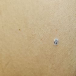 -清疣美疣·痣·斑净肤中心