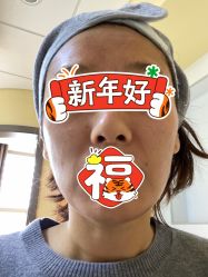 体验后-北京爱育华医院-医疗美容科
