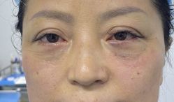 -天津健丽·去眼袋医疗美容机构