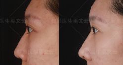 -北京米扬丽格医疗美容·联合丽格鼻整形中心