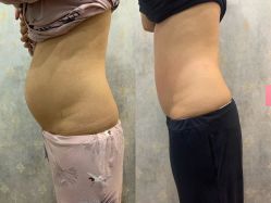 点击看大图 -弗蕾亚·和月月子调理院(东湖店)