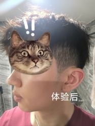 体验后-深圳美莱医疗美容医院