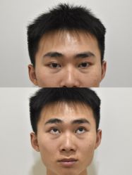 -天津健丽·去眼袋医疗美容机构