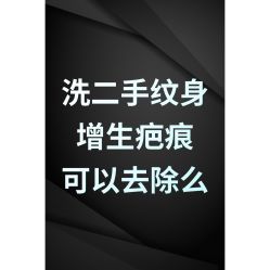 -雲艺刺青·洗纹身