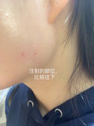 -Yestar艺星医疗美容医院