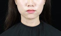 -广州美莱医疗美容医院