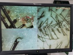 -章光101防脱养发荟