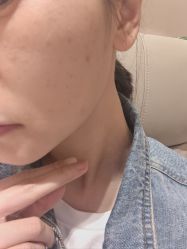 体验前-Yestar杭州艺星医疗美容医院