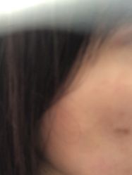 -广州美莱医疗美容医院