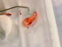 -深圳市人民医院(留医部)