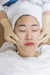 -SKINIST丽铂医疗美容