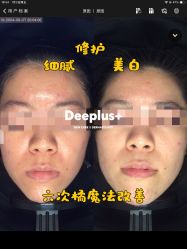 -Deeplus+韩国皮肤管理한국피부관리·C:Lab肌肤实验室